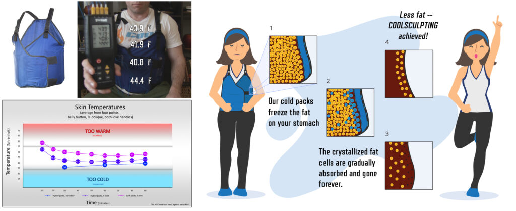 Fat freezing via the Cool Gut Buster.  For educational purposes only.